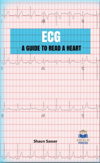 ECG – A Guide To Read A Heart